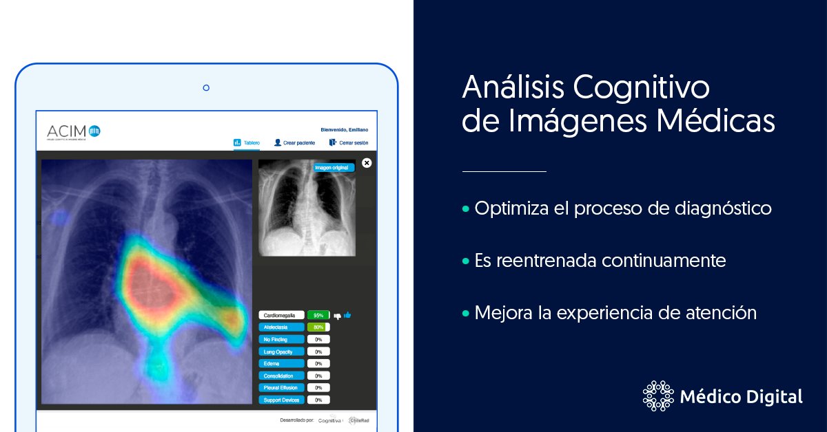 MedDigital_com's tweet photo. Gracias a la alianza estratégica entre @cognitiva_la y @TChilerad creamos Análisis Cognitivo de Imágenes Médicas, una solución de reconocimiento visual de rayos X de tórax ➡️ https://t.co/k7S2HonCF6

#Tecnología #Radiología #Salud #Chile 🇨🇱 https://t.co/JhmELhuTrP