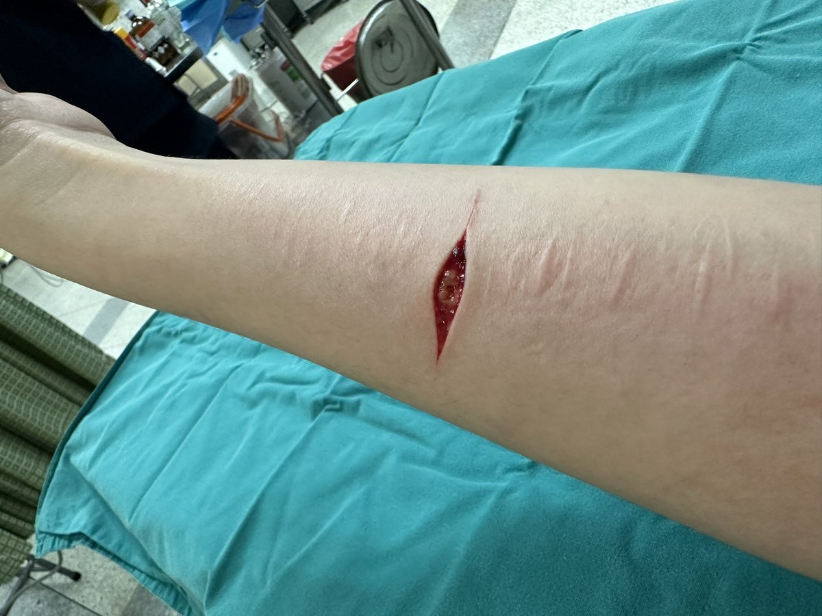 Promiseesimo's tweet photo. การฆ่าตัวตายหรือการทำร้ายตัวเอง มันเหมือนเป็นระยะๆหรือเรียกว่ามันหนักขึ้นไปเรื่อยๆ เป็นระดับๆ😞😔😢 เหนื่อยมากนะ #โรคซึมเศร้า #โรคซึมเศร้า https://t.co/mgy6cXapvQ