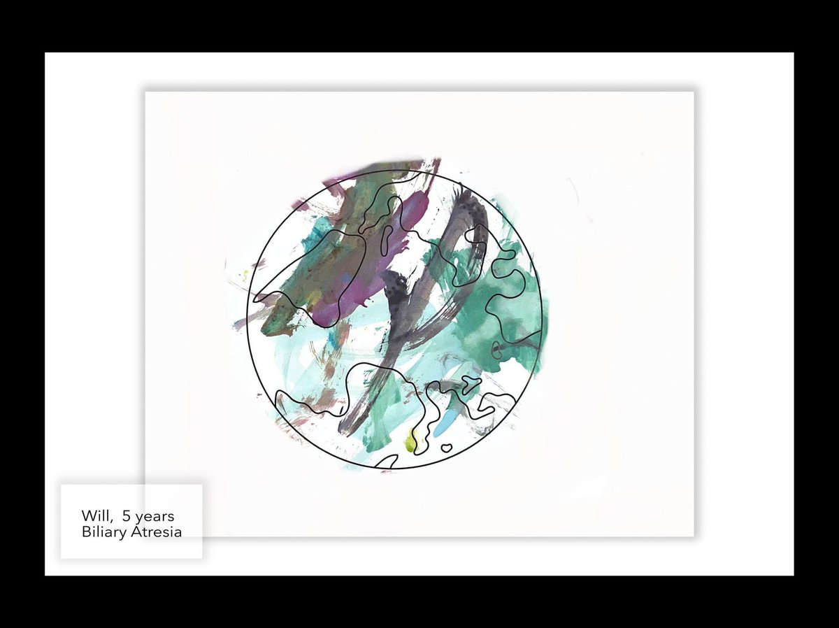 LiverMommas's tweet photo. 2023 Liver Mommas &amp; Families Pediatric Transplant Week Virtual Art Show
#PediatricTransplantWeek #DonateLifeMonth 

Artwork by Will and his sister, Laney.
Will was diagnosed with Biliary Atresia. https://t.co/nhBvmjojP4