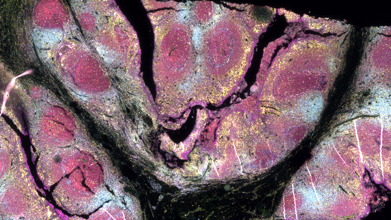 GeneWorks Australia (@geneworksaus) on Twitter photo Excited to announce Australia’s first PhenoCycler®-Fusion high-plex tissue multispectral imaging run. This marks an exciting new phase for Australia’s Spatial Biology Research community. GeneWorks is now accepting samples. <a href="/AkoyaBio/">Akoya Biosciences</a> #spatialbiology #highpleximaging #multispectral Excited to announce Australia’s first PhenoCycler®-Fusion high-plex tissue multispectral imaging run. This marks an exciting new phase for Australia’s Spatial Biology Research community. GeneWorks is now accepting samples. <a href="/AkoyaBio/">Akoya Biosciences</a> #spatialbiology #highpleximaging #multispectral