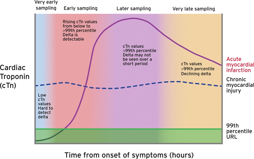 Kidney_Int's tweet photo. Meeting Report
Defining #myocardial #infarction in trials of people receiving #hemodialysis: consensus report from the SONG-HD MI Expert Working group

https://t.co/8FhBXCnibT

@song_initiative @emma_olone @CDRGNews https://t.co/laE9U11M6b