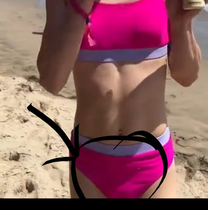 cheli89's tweet photo. @OliLondonTV Omg! What will that small (very small) lump be? ๐ง
Could it be a pimple? ๐ค https://t.co/7GxhanP3wA