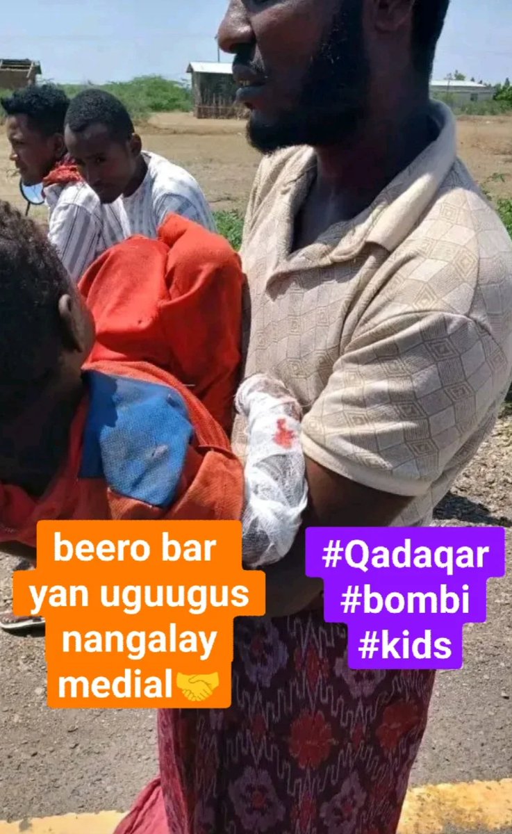 HayuAfar's tweet photo. #Afar 
#bombblast 
#afaregion 
#Ethiopia 
#war An urgent solution must be given ‼️ Children are dying every day due to bombs left buried in the war. The children who are more than two years old in Adar Darsagita are losing their lives in Funju @AbiyAhmedAli https://t.co/b4r71g5tM3