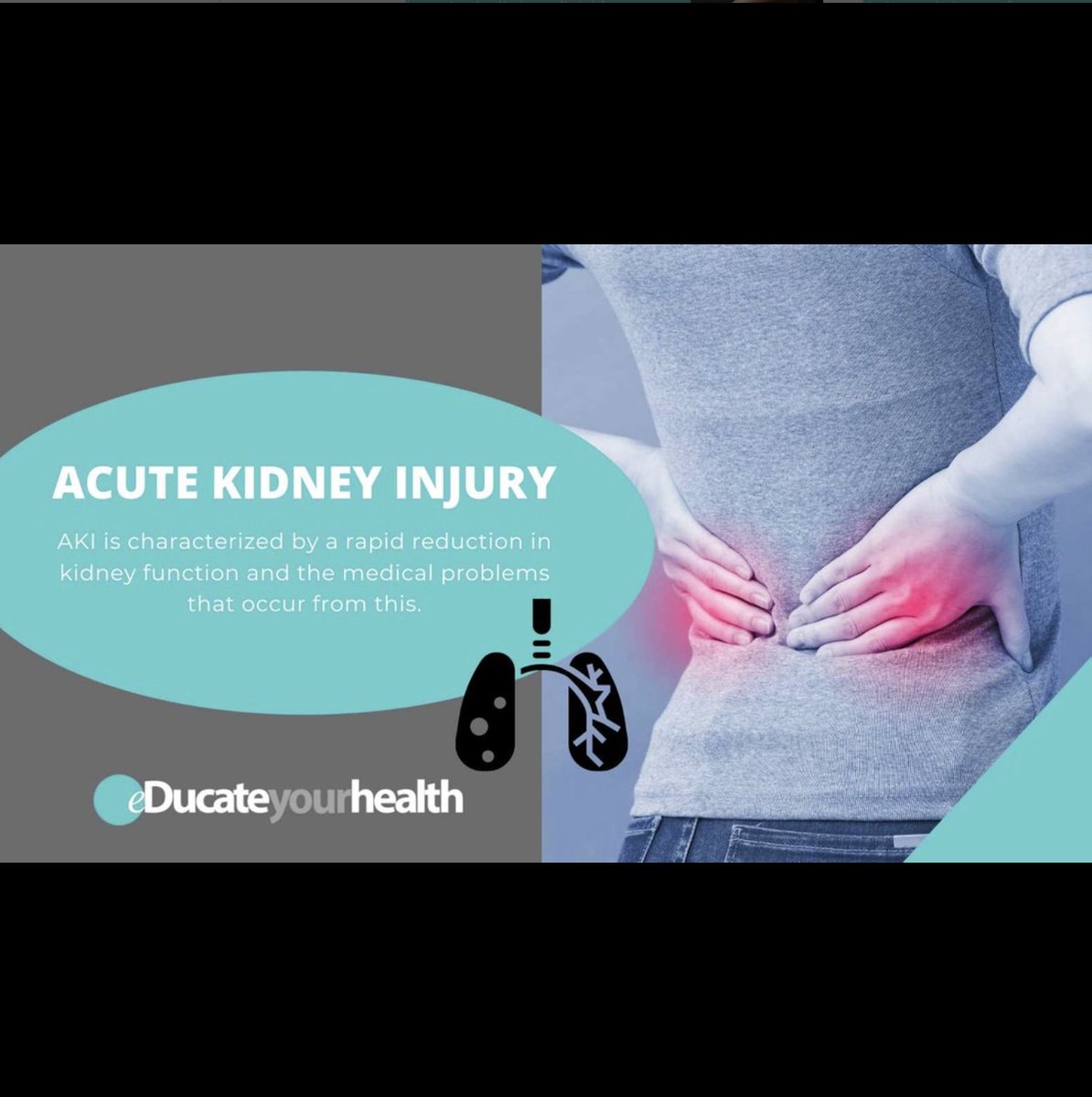Acute kidney failure/injury can be fatal. However, if underlying cause is treated, in most cases kidneys fully recover within a few months. To learn more about it go to our website:

educateyourhealth.com/patients/acute…

#educate #stayhealthy #staysafe #kidneyfailure