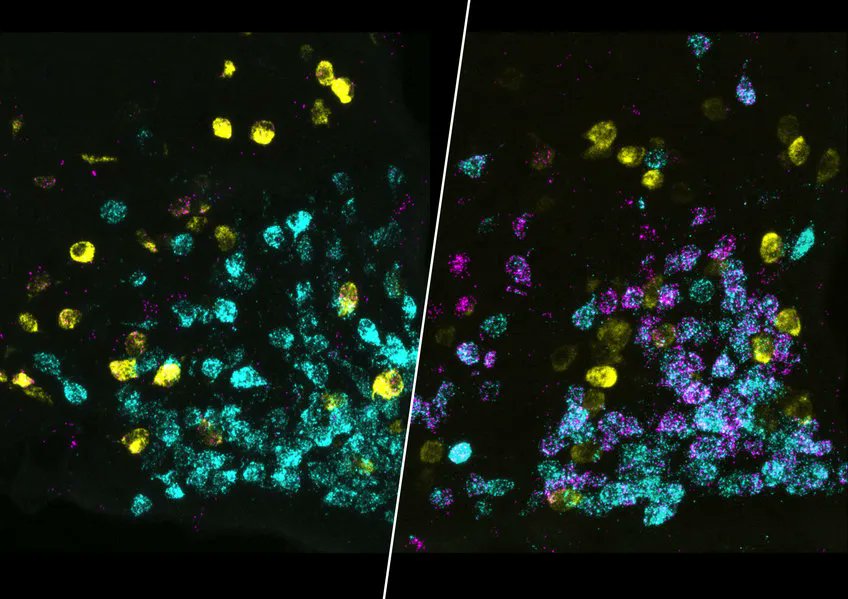 talius's tweet photo. How the #Brain tells the #Liver to start #Recycling after #Fasting
Scientists studied how hypothalamic #AgRP neurons responded to a short fast. The brain not only sends signals that stimulate eating, but also signals that activate #autophagy... https://t.co/gXGyOHH2M6 https://t.co/reEwYnqm6Z