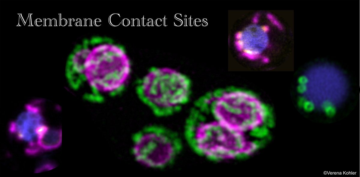 Check out this week's selection of publications on #MembraneContactSites!

biomed.news/bims-mecosi/20…

My favourite:
doi.org/10.1038/s41556…

Thanks to <a href="/Bims_BiomedNews/">Bims: Biomed News</a> for the pre-selection!

#ParkinsonsDisease #Neurodegeneration #MCS #Mitochondria #QualityControl #ESCRT