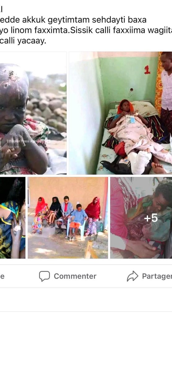 DongoloLoubak's tweet photo. No to #Satrap rules from #Addis_Abeba @awolarba MUST not go to Mekelle until full war reparations 4 Afar is granted. The #TPLF bombs are cleared @getachew_reda must give the bombs placement map @PMAbiy, @DemkeHasen, @ShaleWorkeZewde, @MikeHammerUSA. https://t.co/mUXGogGSo7