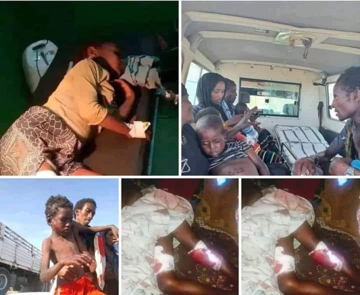 DongoloLoubak's tweet photo. No to #Satrap rules from #Addis_Abeba @awolarba MUST not go to Mekelle until full war reparations 4 Afar is granted. The #TPLF bombs are cleared @getachew_reda must give the bombs placement map @PMAbiy, @DemkeHasen, @ShaleWorkeZewde, @MikeHammerUSA. https://t.co/mUXGogGSo7