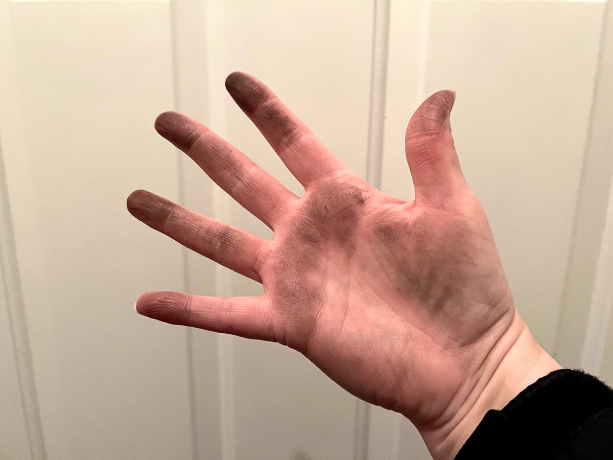 SnowfallSarah's tweet photo. Let’s play a game - You try to figure out why my hand looks like this and I’ll tell you the actual reason tomorrow. (It’s not anything scary.) https://t.co/lAdeMzz1lT