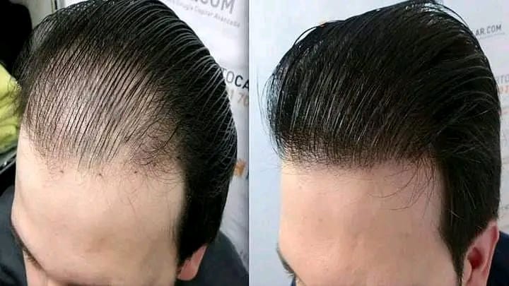 RghdAlghaly's tweet photo. #هل تعانى من تساقط الشعر. ....🤦‍♂🤦‍♀؟
هل شعرك خفيف وفيه فراغات. ....💇‍♂؟
هل شعرك مقصف وغير صحى. ........💇؟
هل شعرك خشن وغير ناعم ..............🙎
هل شعرك يحتاج الى كرياتين ..........🙎

اليكم منتجات فوريفر الطبيعية من الصبار مخصوص للعناية بشعرك وجماله😉 
#شعورك_الحين_يقول https://t.co/13Ic4E4G80