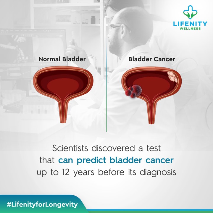 Lifenity1's tweet image. Your life is too precious to leave it to chance. Stay ahead of the curve, stay healthy with the Lifenity Wellness.
#HealthyLiving #BodyFitness #RegularCheckup #BladderCancer #Cancer #CureCancer #Diagnosis #LifenityWellness