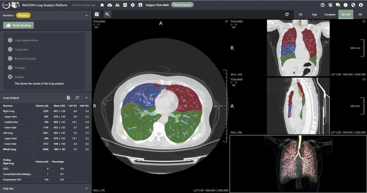 FraunhoferMEVIS's tweet image. More reliable therapeutic decisions? Find out how our SATORI toolkit can provide efficient annotation, segmentation, and image feature quantification at #DMEA2023, hall 2.2, booth D-107.s.fhg.de/LLC
#customizedSoftware #WeKnowSolutions