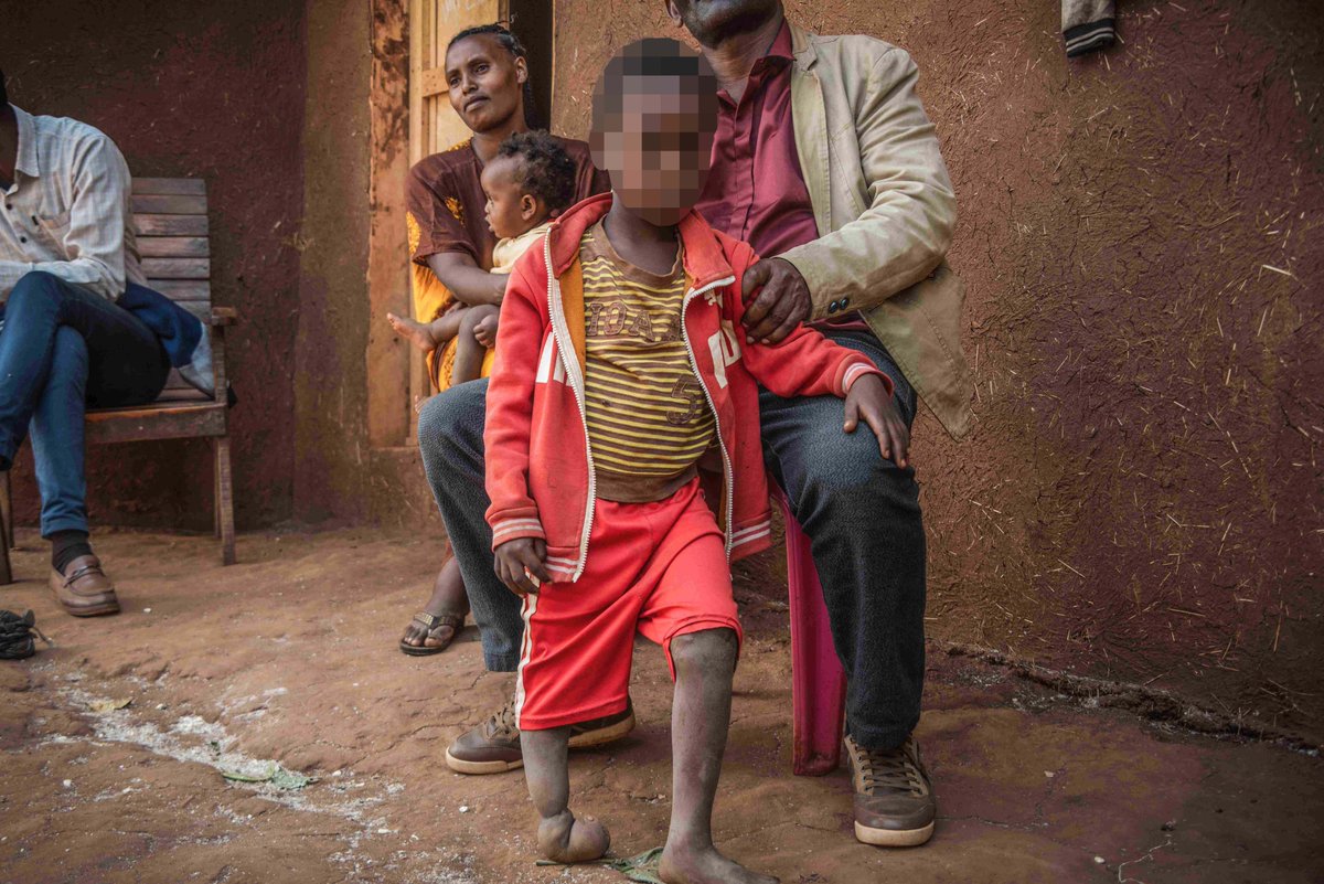 LaetitiaBader's tweet photo. 1/ #Ethiopia’s Lega Dembi gold mine #Oromia  closed in 2018 because of horrific health impacts from decades of pollution. It then reopened in 2021 w/o compensating victims &amp; no apparent steps to address pollution. New report @hrw https://t.co/4iyHnFTK1E https://t.co/WARnIegKjm