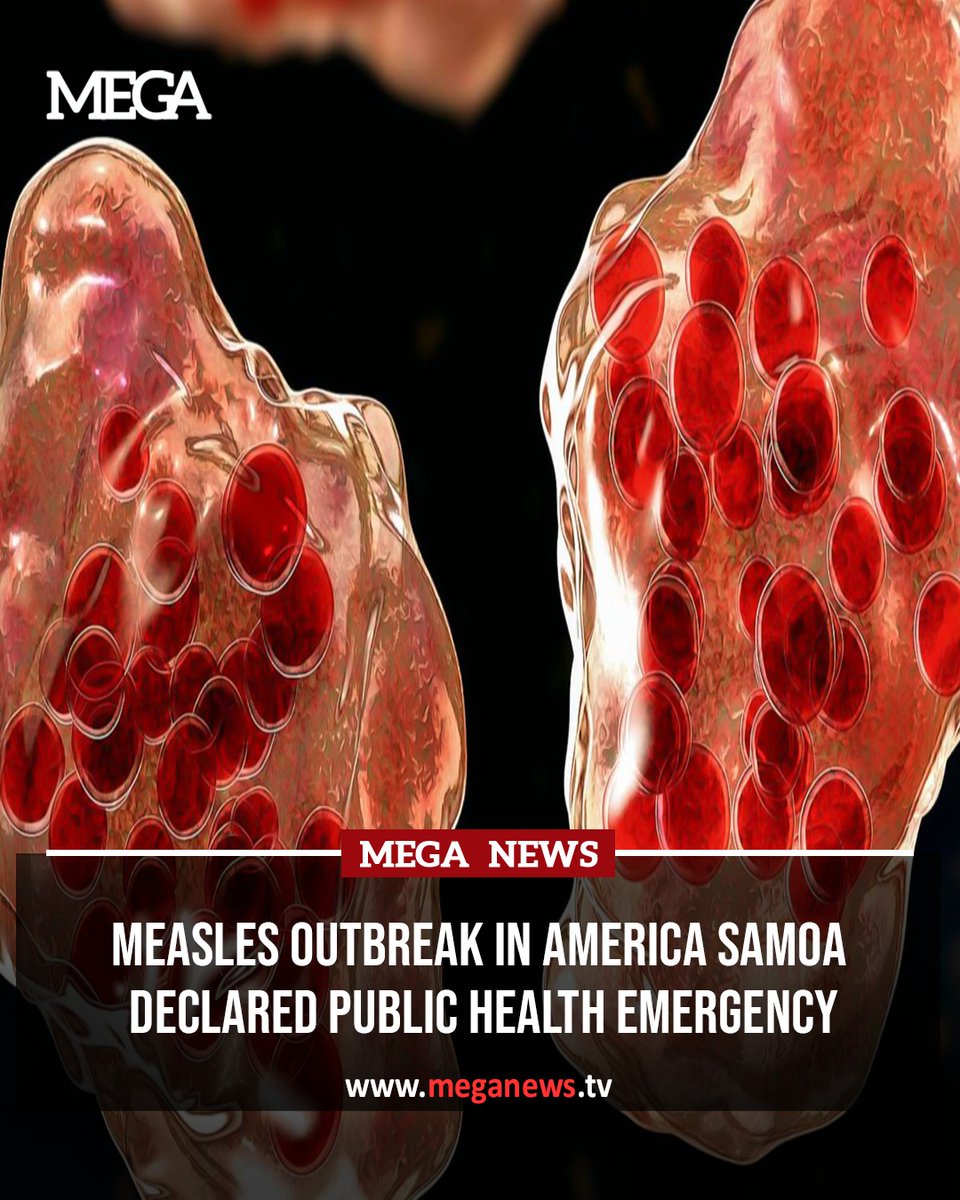 Measles outbreak in America Samoa declared public health emergency

To read the full article click⤵️
meganews.tv/measles-outbre…

#meganewstv #megalifestyletv #MeaslesOutbreak #AmericanSamoa #PublicHealthEmergency