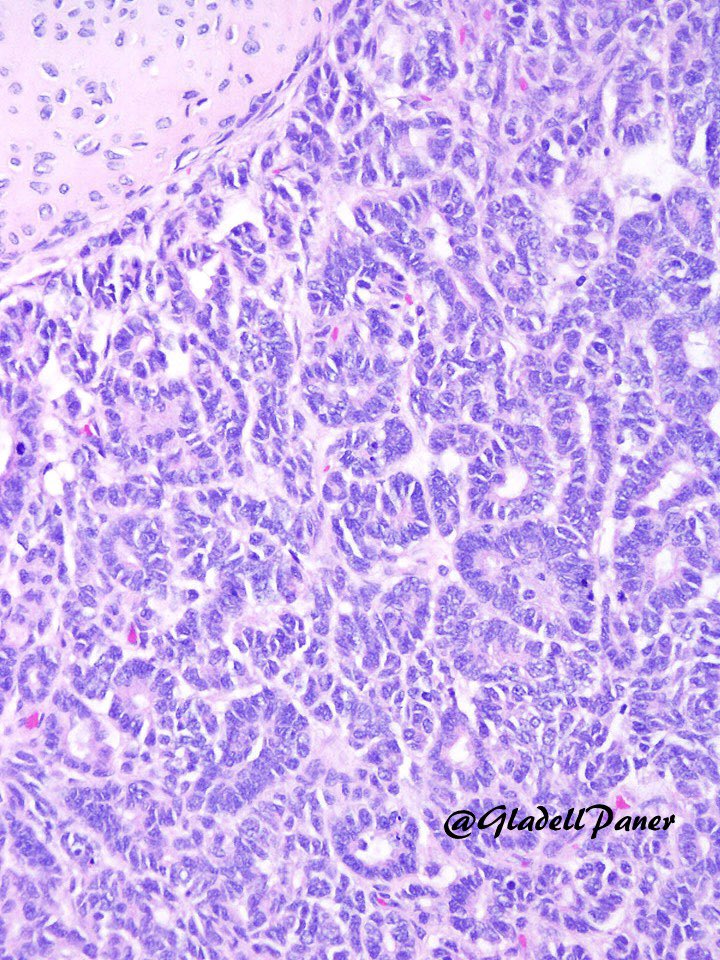 Gladell Paner, MD tweet media