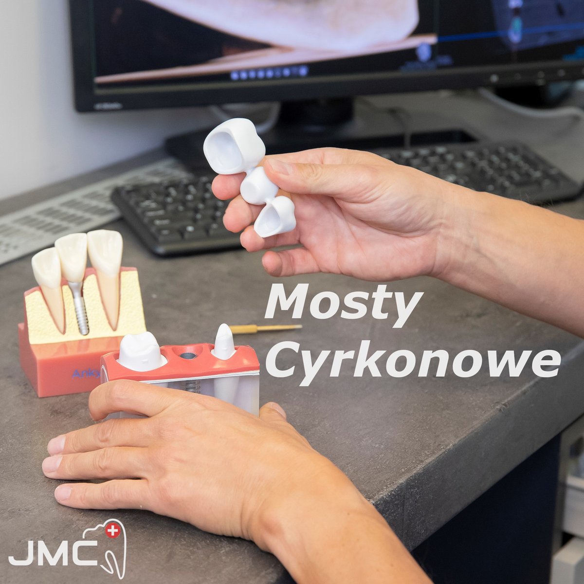 stomatolog_lodz's tweet photo. Cyrkon Multilayer to nowa era stomatologii!🤩 Dzięki naturalnemu gradientowi🌈 i wyśmienitej wytrzymałości mechanicznej💪 Cyrkon zaczyna być częściej stosowany niż standardowe mosty metalowo-porcelanowe🚀
#mosty #mostycyrkonowe #koronycyrkonowe #protetyka

https://t.co/3X8RggYepb https://t.co/xTdLvR7GYw
