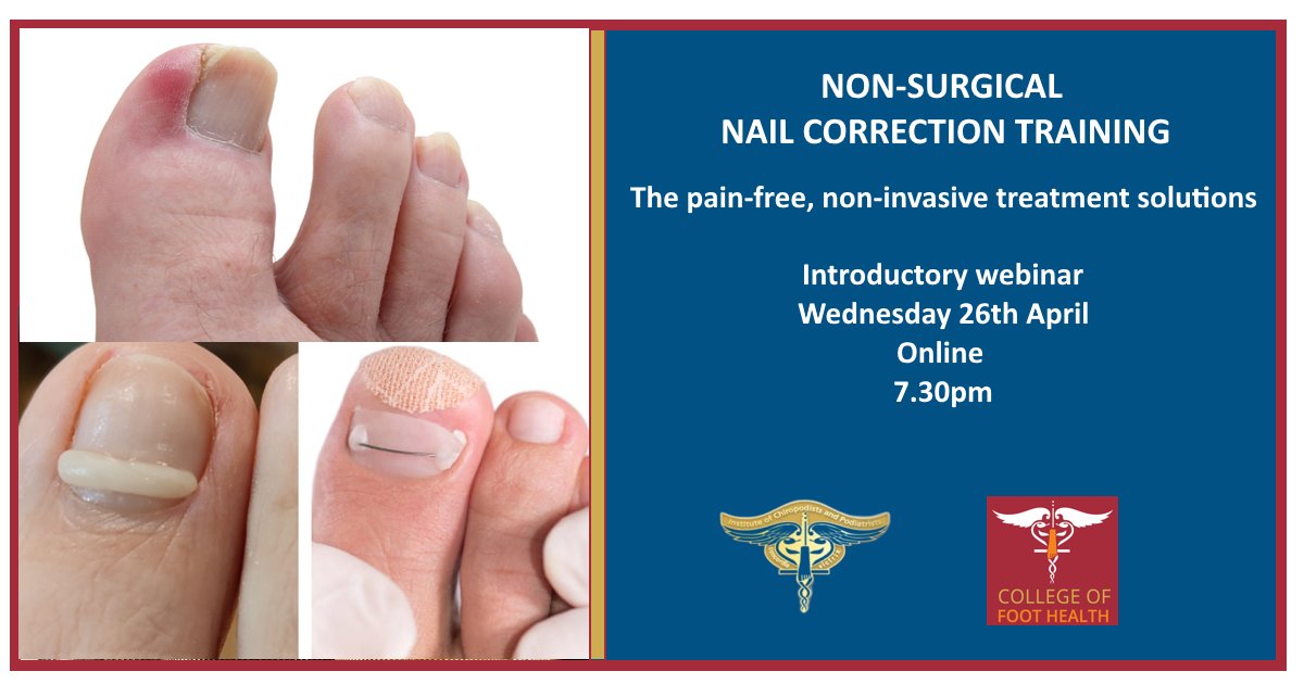 TheCoFH's tweet photo. This evening's FREE CPD webinar; Nail correction - nail bracing and correction solutions. Open to all, register here https://t.co/IpPJjuJwDS or contact info@cofh.org.uk #FHP #Foothealth #foothealthpractitioner #nailcorrection https://t.co/bdWempXrQP
