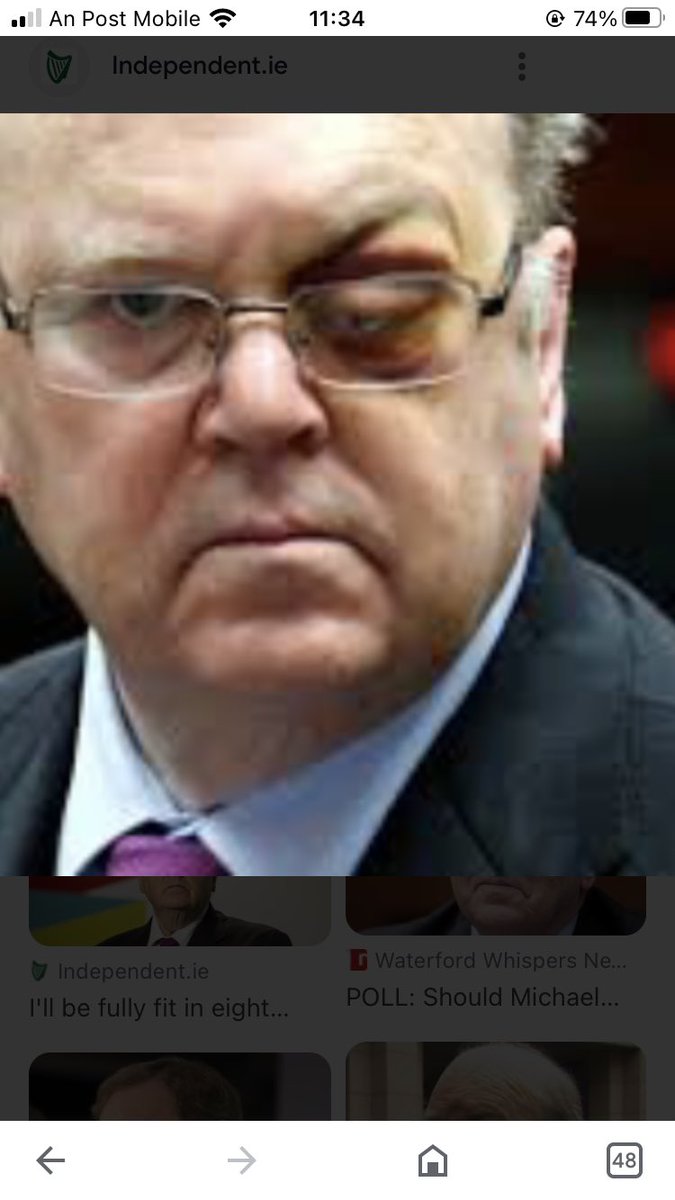 duzBme's tweet photo. @cotupacs @TJB32177616 Same as the black eye conspiracy.
BTW Single pic is Former Irish Min Justice Michael Noonan the most evil, corrupt politician Ireland 🇮🇪 has had. And Ireland has had many. https://t.co/4lDCmYmRrj
