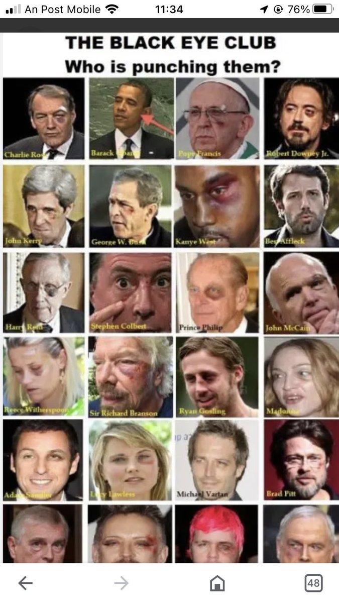 duzBme's tweet photo. @cotupacs @TJB32177616 Same as the black eye conspiracy.
BTW Single pic is Former Irish Min Justice Michael Noonan the most evil, corrupt politician Ireland 🇮🇪 has had. And Ireland has had many. https://t.co/4lDCmYmRrj