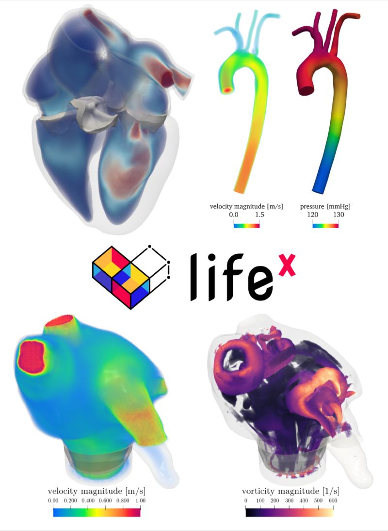 iHEARTsimulator's tweet photo. Interested in #cardiovascular #CFD simulations in a fully #open-#access framework?
We are excited to announce #lifex-#cfd, an open-source solver for cardiovascular CFD.
📚preprint:
https://t.co/UDnzM5AtaH
💻software:
https://t.co/cnPT9JZyCL https://t.co/ft1TNB1zar