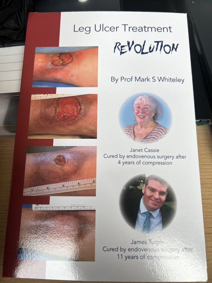 MarkWhiteley's tweet image. At the Houses of Parliament this afternoon- spreading the message that most venous leg ulcers are curable with endovenous surgery #ulcer #VLU #veins
