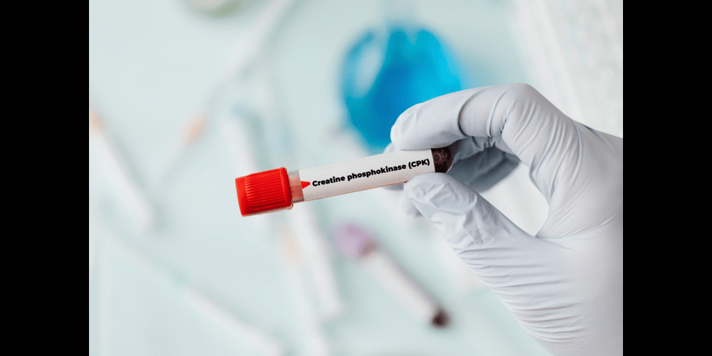 Thyrocare Blood Test Center (ThyrocareBeguru) / Twitter