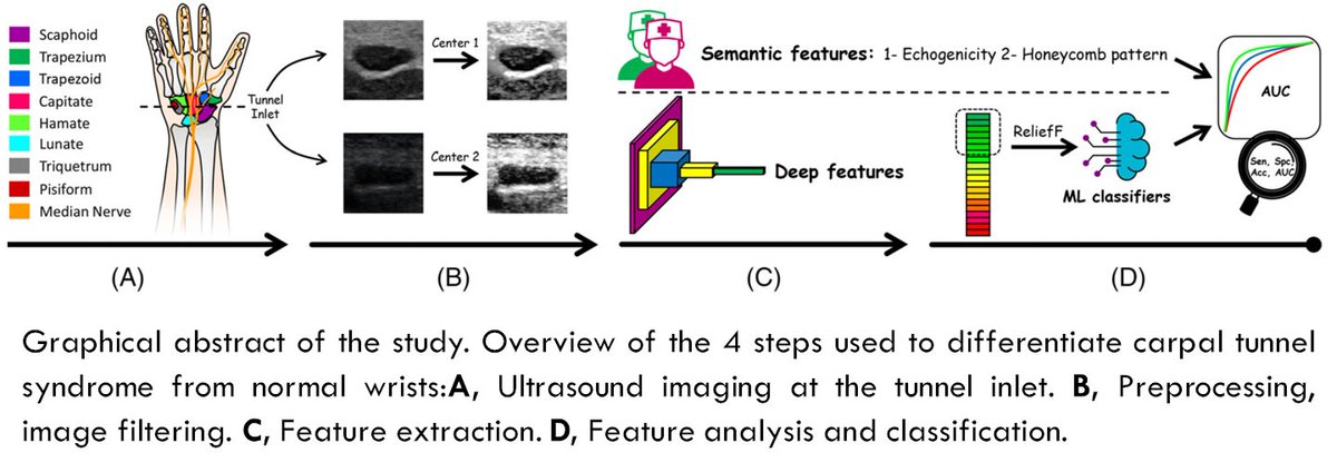 Alimedphysics's tweet photo. Our new #MultiCenter international study indicated that the proposed #CAD system based on #DeepRadiomics outperformed radiologists in predicting #CarpalTunnelSyndrome using #Ultrasonography in both internal (Iran) and external (Columbia) validation datasets!
@AIUMultrasound https://t.co/LiWLwi8jEr