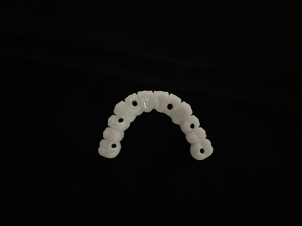 jackwangzixiao's tweet photo. Implant restore. #crown #implant #dentist #dental #fixed #zirconia #DentalHygiene https://t.co/bmIaGSpSnb