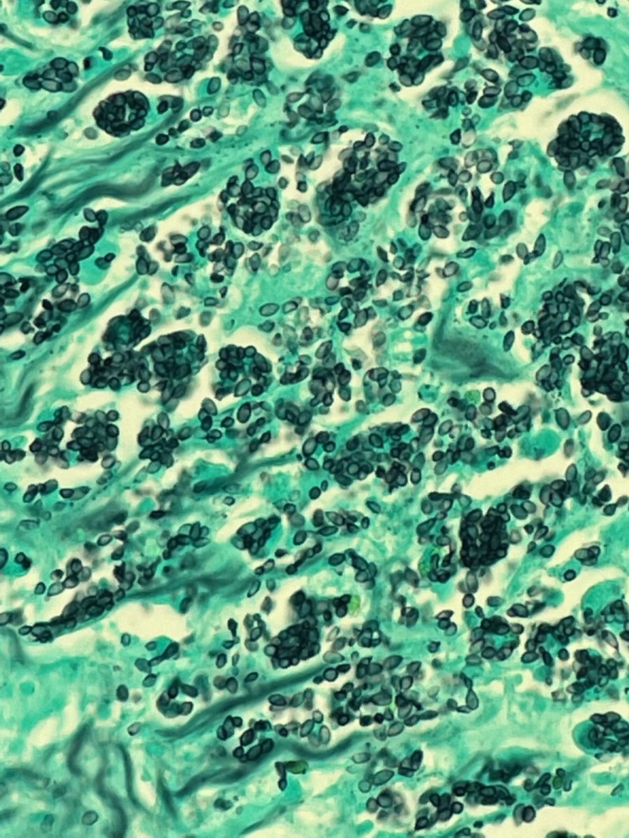 megothelioma's tweet photo. A very common finding 'round these parts of Tennessee🤠any guesses?

#PathTwitter #microbiology https://t.co/MczLlY3kC0
