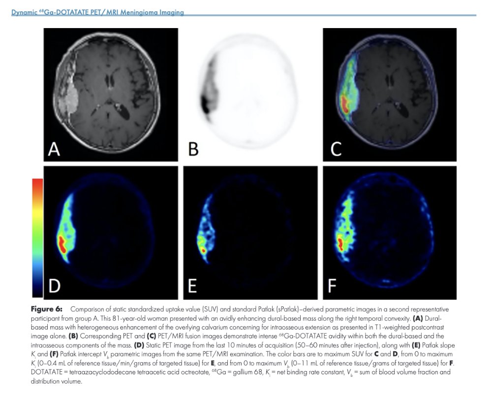 Mariam Aboian (@mariamaboian) on Twitter photo Congratulations <a href="/jana_ivanidze/">Jana Ivanidze</a> <a href="/MolecularWCM/">WCM Molecular Imaging and Therapeutics</a> <a href="/WCMRadiology/">Weill Cornell Medicine Radiology</a> @WCMCBrainSpine She is an expert in Molecular Imaging of Brain Tumors! Well deserved!!! Including our #NeuroNucMed community to🥳! <a href="/Ali_Nabavizadeh/">Ali Nabavizadeh</a> <a href="/ph_lohmann/">Philipp Lohmann</a> <a href="/galldiks/">Norbert Galldiks</a> <a href="/LabBarajas/">Barajas Lab</a> <a href="/mveronesi07/">Michael C Veronesi, M.D., Ph.D.</a> <a href="/SNM_MI/">SNMMI</a> <a href="/TheASNR/">The American Society of Neuroradiology</a> <a href="/theASFNR/">American Society of Functional Neuroradiology</a> Congratulations <a href="/jana_ivanidze/">Jana Ivanidze</a> <a href="/MolecularWCM/">WCM Molecular Imaging and Therapeutics</a> <a href="/WCMRadiology/">Weill Cornell Medicine Radiology</a> @WCMCBrainSpine She is an expert in Molecular Imaging of Brain Tumors! Well deserved!!! Including our #NeuroNucMed community to🥳! <a href="/Ali_Nabavizadeh/">Ali Nabavizadeh</a> <a href="/ph_lohmann/">Philipp Lohmann</a> <a href="/galldiks/">Norbert Galldiks</a> <a href="/LabBarajas/">Barajas Lab</a> <a href="/mveronesi07/">Michael C Veronesi, M.D., Ph.D.</a> <a href="/SNM_MI/">SNMMI</a> <a href="/TheASNR/">The American Society of Neuroradiology</a> <a href="/theASFNR/">American Society of Functional Neuroradiology</a>