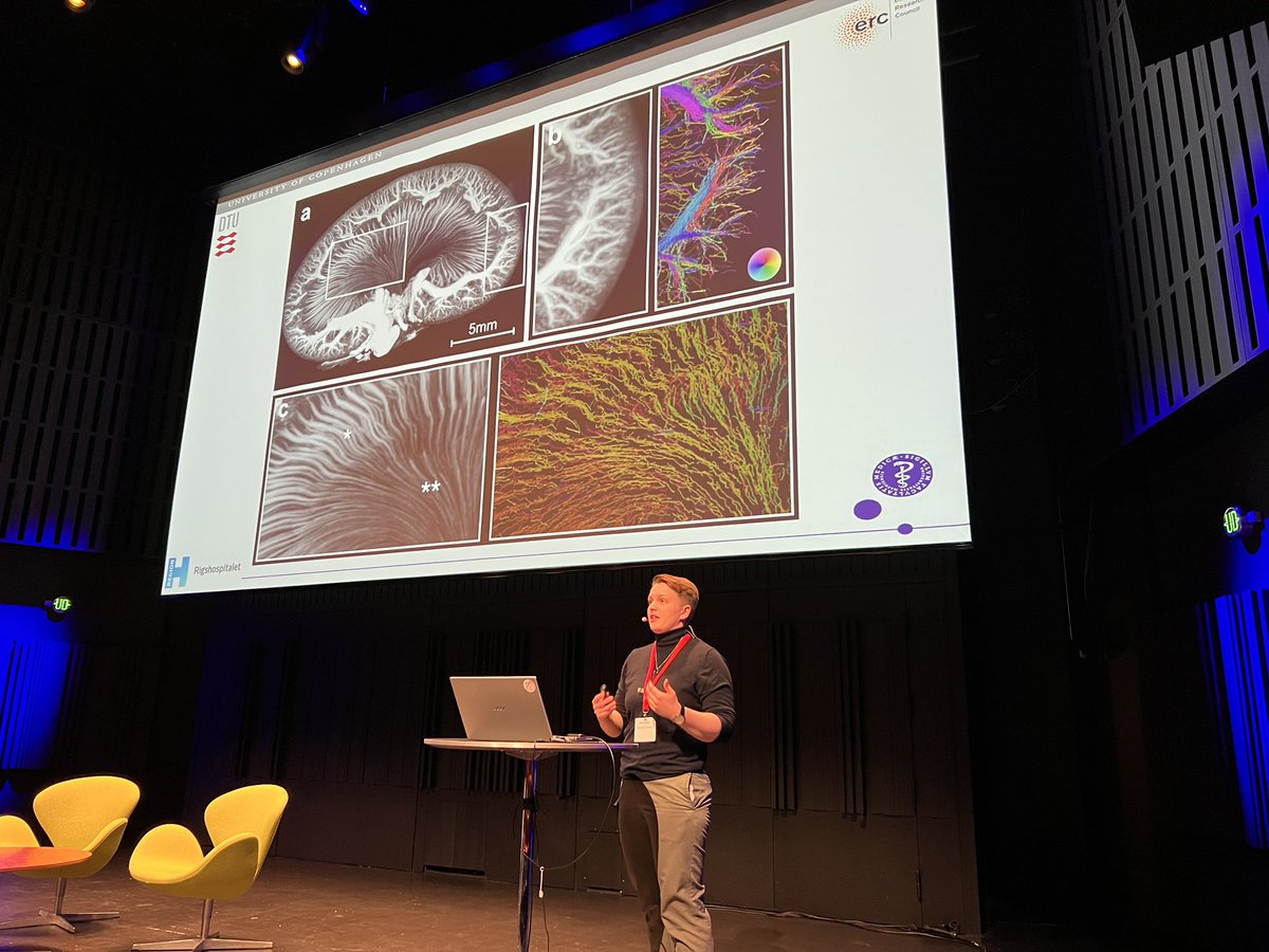CharlotteMehlin's tweet photo. Great presentation by PhD student Amy McDermott on early microvascular changes in the diabetic #Kidney imaged with #SRUS 🤗 I’m really proud! Thank you for great collaborations @stinnebyrholdt @i_taghavi @mostafaaminnaji 👍🏻 @BiomedUCPH @ERC_Research @DTU_Ultrasound #ESM2023 https://t.co/t6XB7RHo3A
