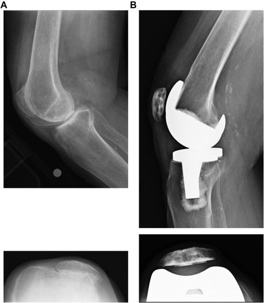 The Journal of Arthroplasty tweet media