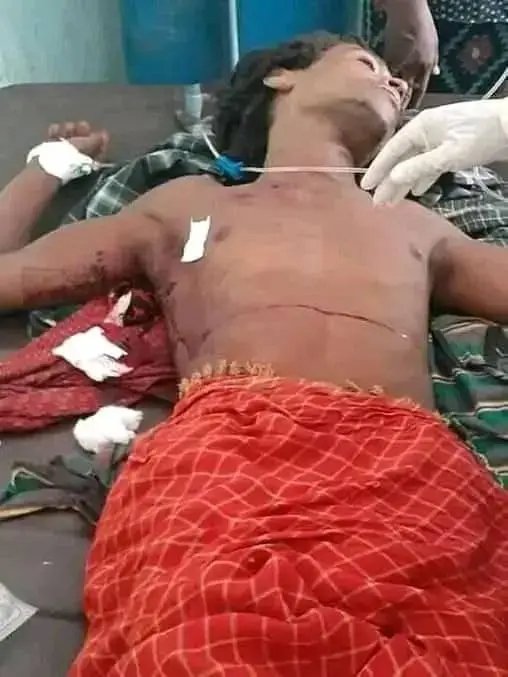kalilibnali's tweet photo. SILENCE is not the ANSWER:
#Afar regional government should break its silence and lead charge of the demining operation in #Kasagita district. Afar can't afford to sit idly while our children die daily at the hands of UXOs.
#Attention4Kasagita
#Kassagita https://t.co/z3cgqE008b