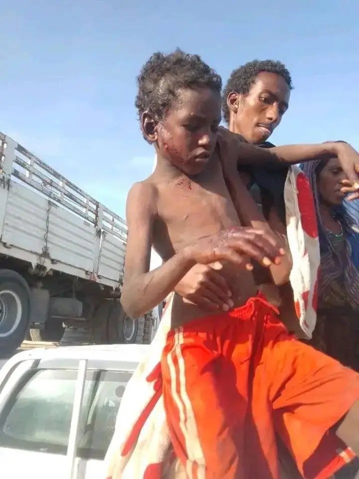 kalilibnali's tweet photo. SILENCE is not the ANSWER:
#Afar regional government should break its silence and lead charge of the demining operation in #Kasagita district. Afar can't afford to sit idly while our children die daily at the hands of UXOs.
#Attention4Kasagita
#Kassagita https://t.co/z3cgqE008b