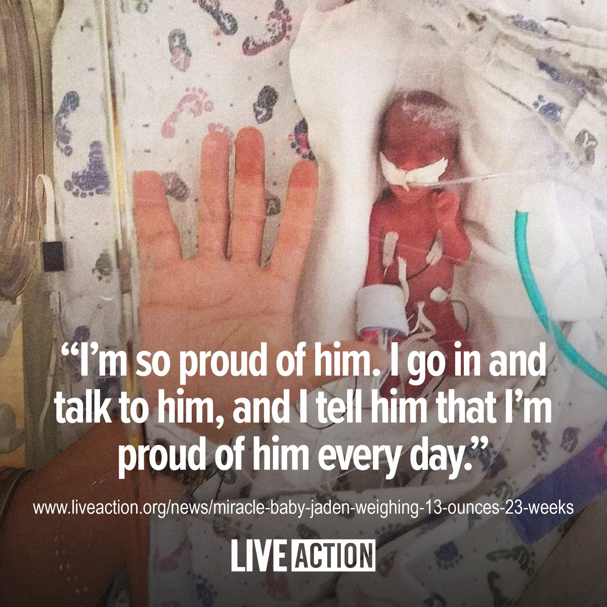 LiveAction's tweet photo. Baby Jaden was born extremely premature at just 23 weeks and 1 day gestation. Weighing only 13 ounces, he was the smallest baby in 10 years to be born at Blank Children's Hospital in Des Moines, Iowa.

While doctors and his family were concerned about his early arrival, Jaden was a fighter. He underwent several surgeries and continued to grow every day.

Doctors called him "remarkable" and "a miracle baby." His mother says she's nothing but thankful. "Jaden is here, and that's all that matters."

Babies even younger than Jaden have survived and thrived after being born prematurely. A 2015 study in the New England Journal of Medicine states that babies born at 22 weeks have a nearly 25% survival rate if properly treated - pointing to 22 weeks being the new age of viability rather than 24 weeks.

Yet babies just like Jaden are killed every day in the womb. All babies deserve the chance to live and to be provided with proper medical care. Like and share if you agree.