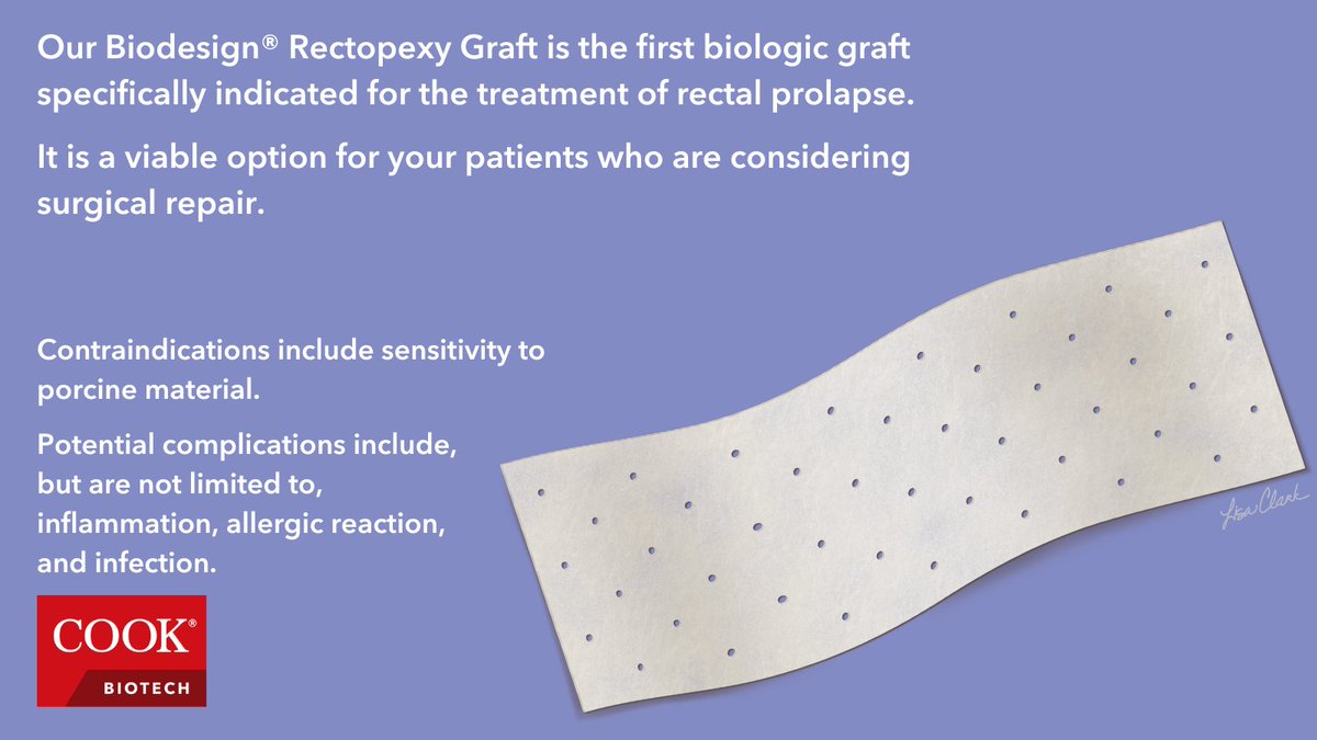 Cook_Biotech's tweet photo. This is the graft specifically indicated for the repair of rectal prolapse. For instructions for use, click here: https://t.co/hPNruKrWzM
#cookbiotech #rectopexy #rectalprolapse https://t.co/wDh3jmo0bD
