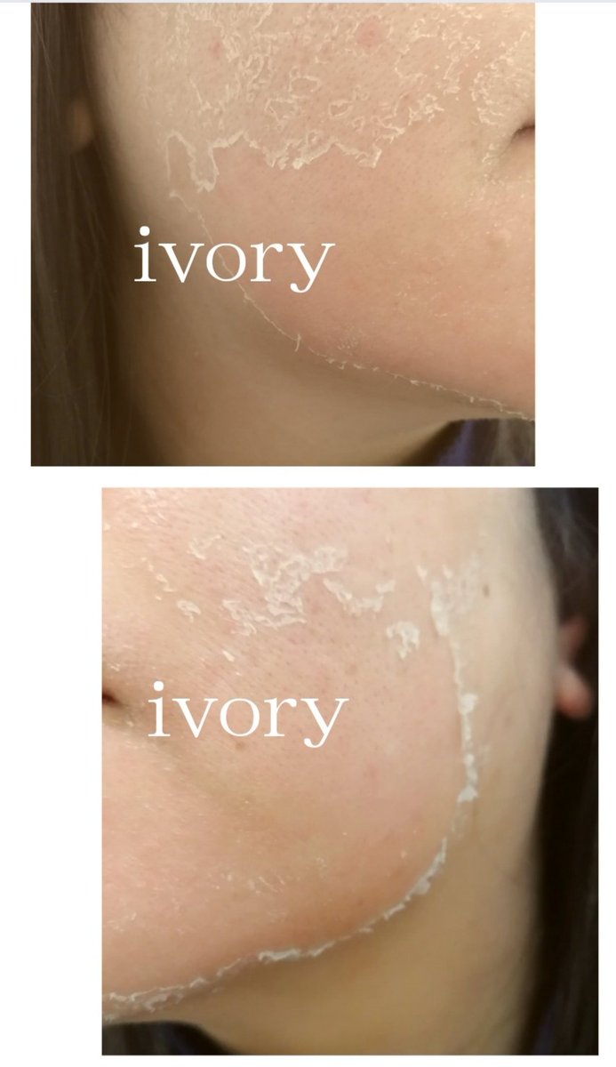 ハーブピーリング 剥離あり 皮向けあり 10回分→10g ハーブ