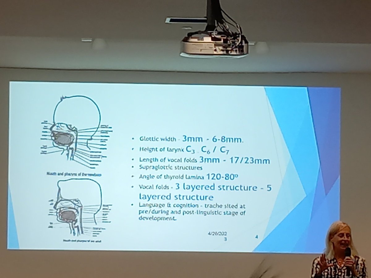 Basildon Hospital SLT Team (@slt_bashosp) on Twitter photo Thanks to <a href="/RCSLTTracheCEN/">RCSLTTracheCEN</a> for putting on such a great day. Really applicable knowledge of #OWV across a whole cohort of patients Thanks to <a href="/RCSLTTracheCEN/">RCSLTTracheCEN</a> for putting on such a great day. Really applicable knowledge of #OWV across a whole cohort of patients