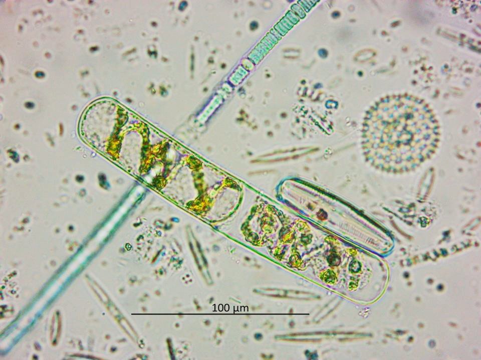 Una gota de agua del Salar de Tara es un universo microbiano 🔬🦠 microalgas, protistas, bacterias, diatomeas, base trófica del ecosistema #TaraNoSeToca #ProtejamosLosSalares 🏜🦩