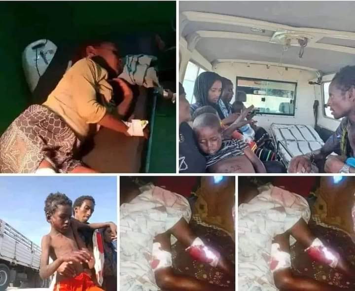 ErerKee's tweet photo. This is no Yemen or Sudan this is in Ethiopia afar kasagita
Afar can't afford to sit idly while our children die daily at the hands of UXOs.
#Attention4Kasagita
#Kassagita
@EthioHRC @UNICEF @AbiyAhmedAli  @PMEthiopia https://t.co/P6CKrbDNr6
