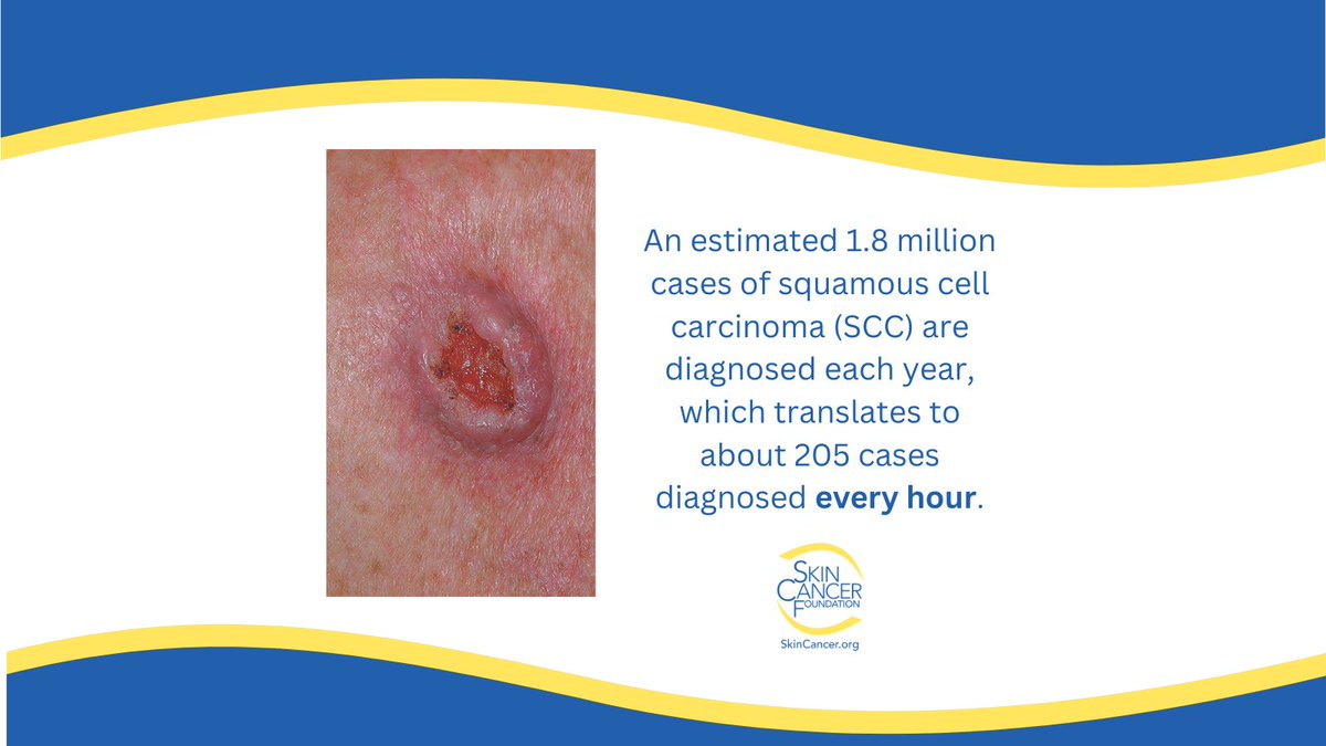 SkinCancerOrg tweet picture