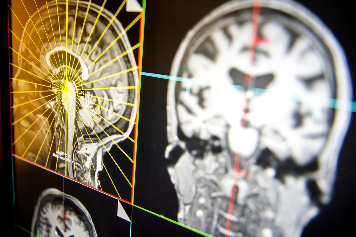 Northeastern COS (@northeasterncos) on Twitter photo Your mental health matters.
“We chose to combine real-time neurofeedback with mindfulness meditation so individuals could train to calm their minds based on their own brain activities in real-time,” says, <a href="/jiahezhang_phd/">Jiahe Zhang</a>.
Learn more: cos.nu/3Aik48f
#COSConnects Your mental health matters.
“We chose to combine real-time neurofeedback with mindfulness meditation so individuals could train to calm their minds based on their own brain activities in real-time,” says, <a href="/jiahezhang_phd/">Jiahe Zhang</a>.
Learn more: cos.nu/3Aik48f
#COSConnects