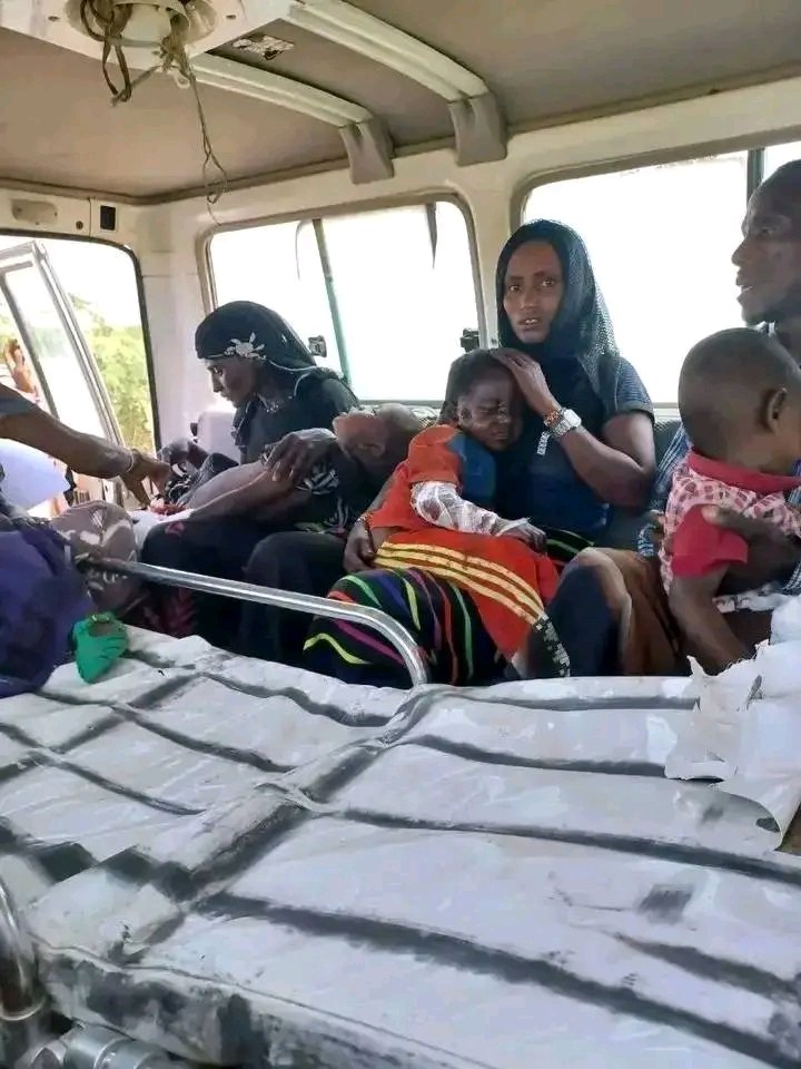 Dankaliann's tweet photo. Afar children are still dying by z bombs that were installed by the tplf during their war on Afar pastoralists.
#attention4kasagita 
#Afar 
@AbiyAhmedAli 
@RedwanHussien 
@walta_info 
@WHOEthiopia 
@awolarba 
@EPHIEthiopia 
@mfaethiopia 
@DemekeHasen 
@FMoHealth https://t.co/5k1re3aN47
