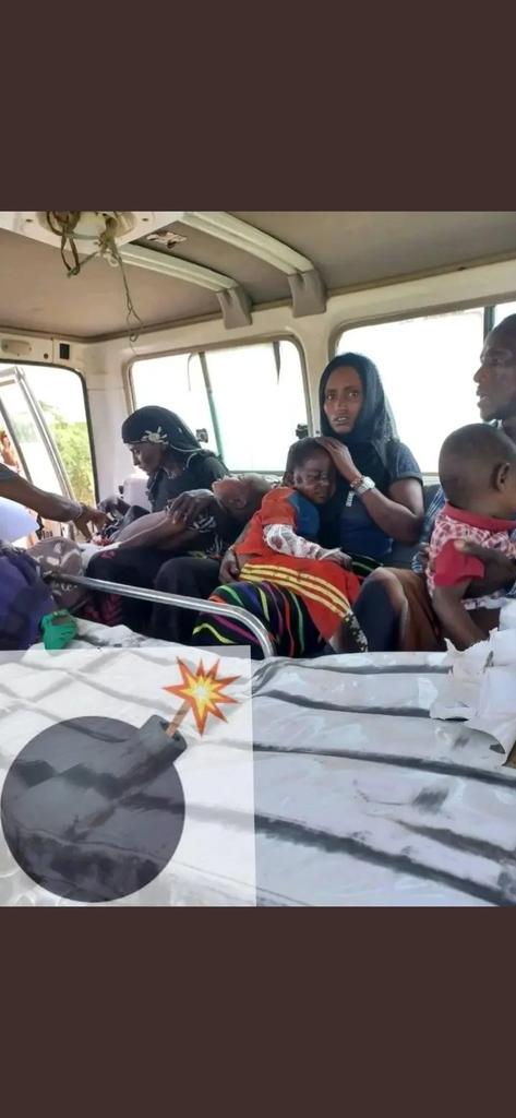Alihalo31's tweet photo. Changing the spoon of the dish will never change the taste of the food , z some is true in our region , while seeing the innocent children dying on earth mines remainedduring war is z kept deaf 👂#darsagita @UNICEF @AbiyAhmedAli @DemekeHasen @SahleWorkZewde https://t.co/bGPWdLxk2F
