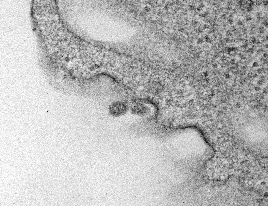 scisignal's tweet photo. How does #SARSCoV2 infect #macrophages? A study from Schroder (@inflammasomelab), @LarisaLabzin, and co. shows the virus enters both ACE2-expressing and -deficient macrophages, but replicates and triggers antiviral responses only in ACE2-expressing cells. https://t.co/YL0xQuiDpZ https://t.co/qZ9oLpOKds