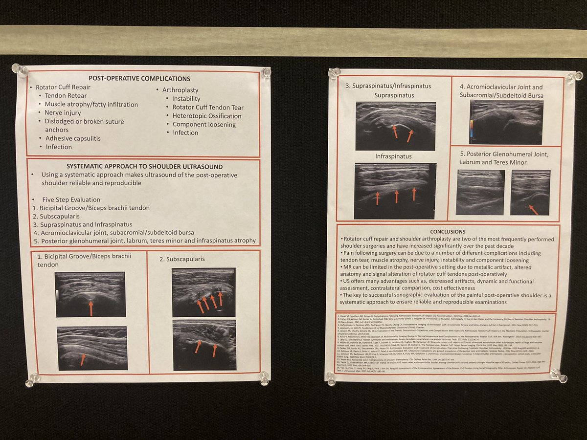 UCRadRes (@ucradres) on Twitter photo Check out the wonderful poster by <a href="/ELanserMSKRad/">Erica Lanser, MD</a> on the post operative shoulder #AUR23 @AURtweet Check out the wonderful poster by <a href="/ELanserMSKRad/">Erica Lanser, MD</a> on the post operative shoulder #AUR23 @AURtweet