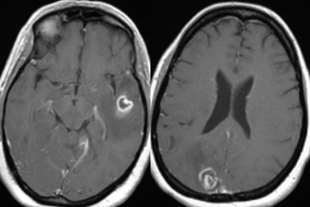 Daniel Gewolb, MD on Twitter: