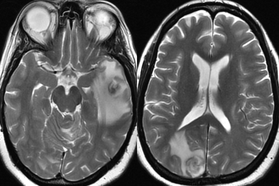 Daniel Gewolb, MD on Twitter: