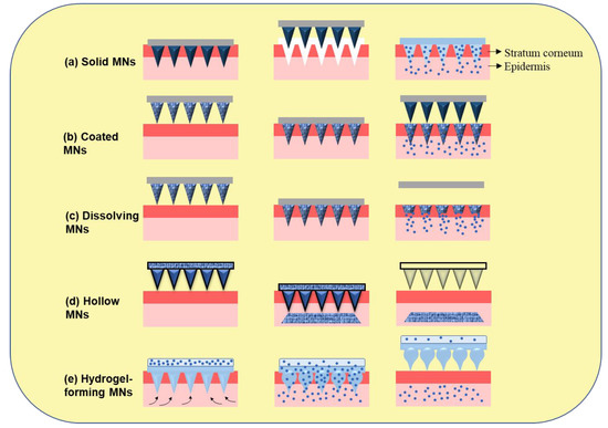 MDPIpharma's tweet image. Read the latest research by “Revolutionizing Therapeutic #Delivery with #Microneedle Technology for #Tumor Treatment”. 

You can find it at the link:   mdpi.com/1999-4923/15/1…