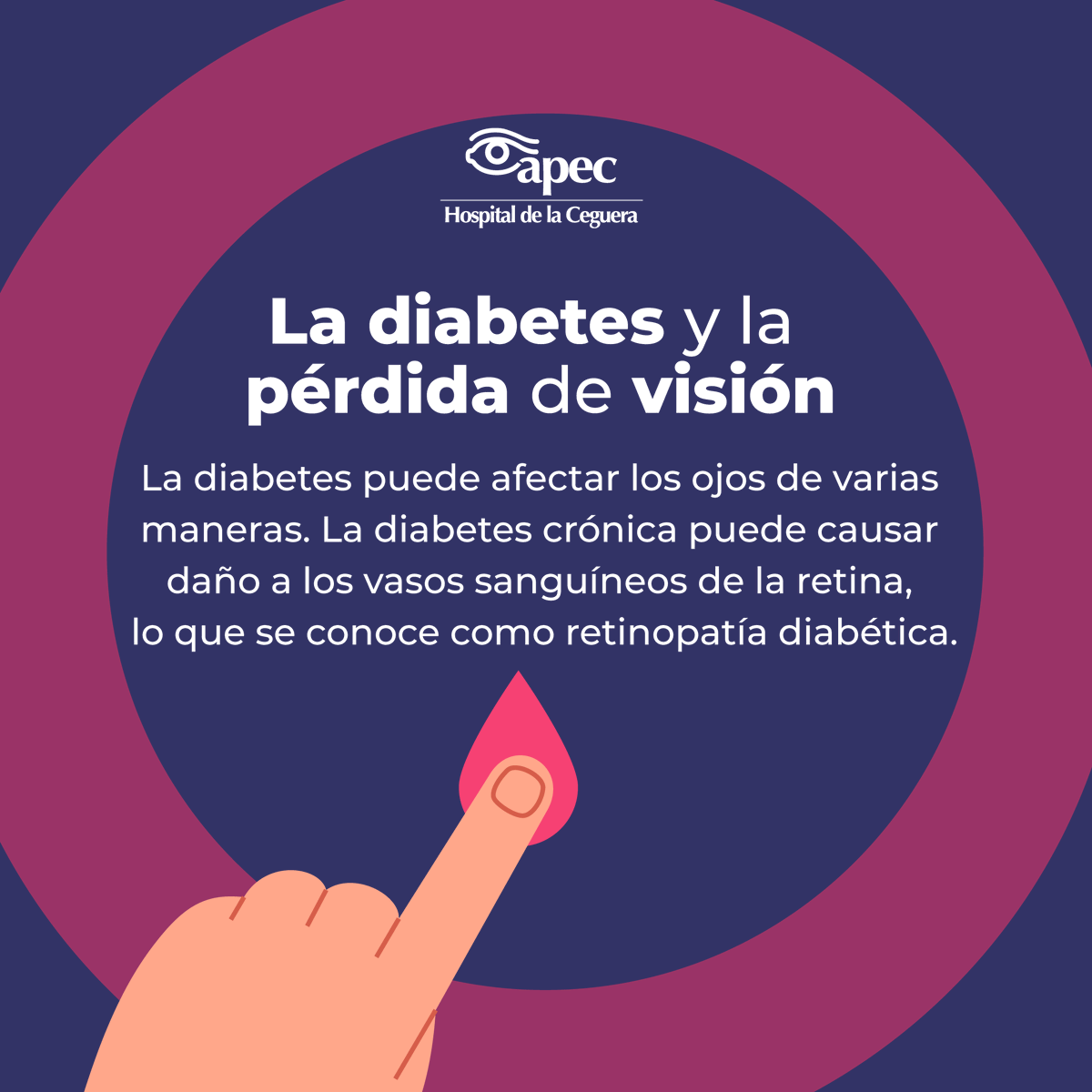 HospitalApec's tweet photo. La retinopatía diabética es la principal causa de ceguera en adultos en edad laboral en todo el mundo. Aproximadamente el 80% de las personas que han padecido diabetes por más de 20 años presentan algún grado de retinopatía diabética.
#UnidadDeInvestigación #APEC #HospitalAPEC https://t.co/n1hnnPMUbh